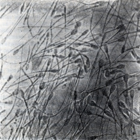 Сперматозоиды человека под микроскопом | Пикабу